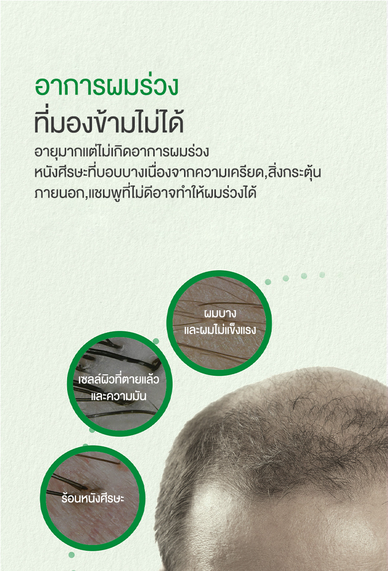 SOME BY MI,SOME BY MI Cica Peptide Anti Hair Loss Derma Scalp Tonic 150ml ,Cica Peptide Anti Hair Loss Derma Scalp Tonic 150ml,สเปรย์บำรุงผมและหนังศรีษะ,ผมร่วง,